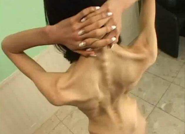 Taffy reccomend anorexic looking porn star